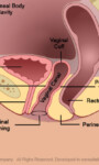 Update on IC and Vulvodynia:  3 Energy Science Solutions