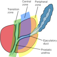 IC and Chronic Prostatitis:  A 5 Step Plan of Attack